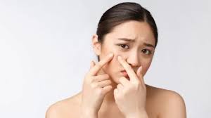 Kesehatan Kulit Remaja Cara Aman Lawan Jerawat Tanpa Ngerusak Wajah